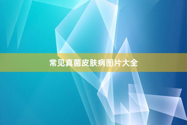 常见真菌皮肤病图片大全